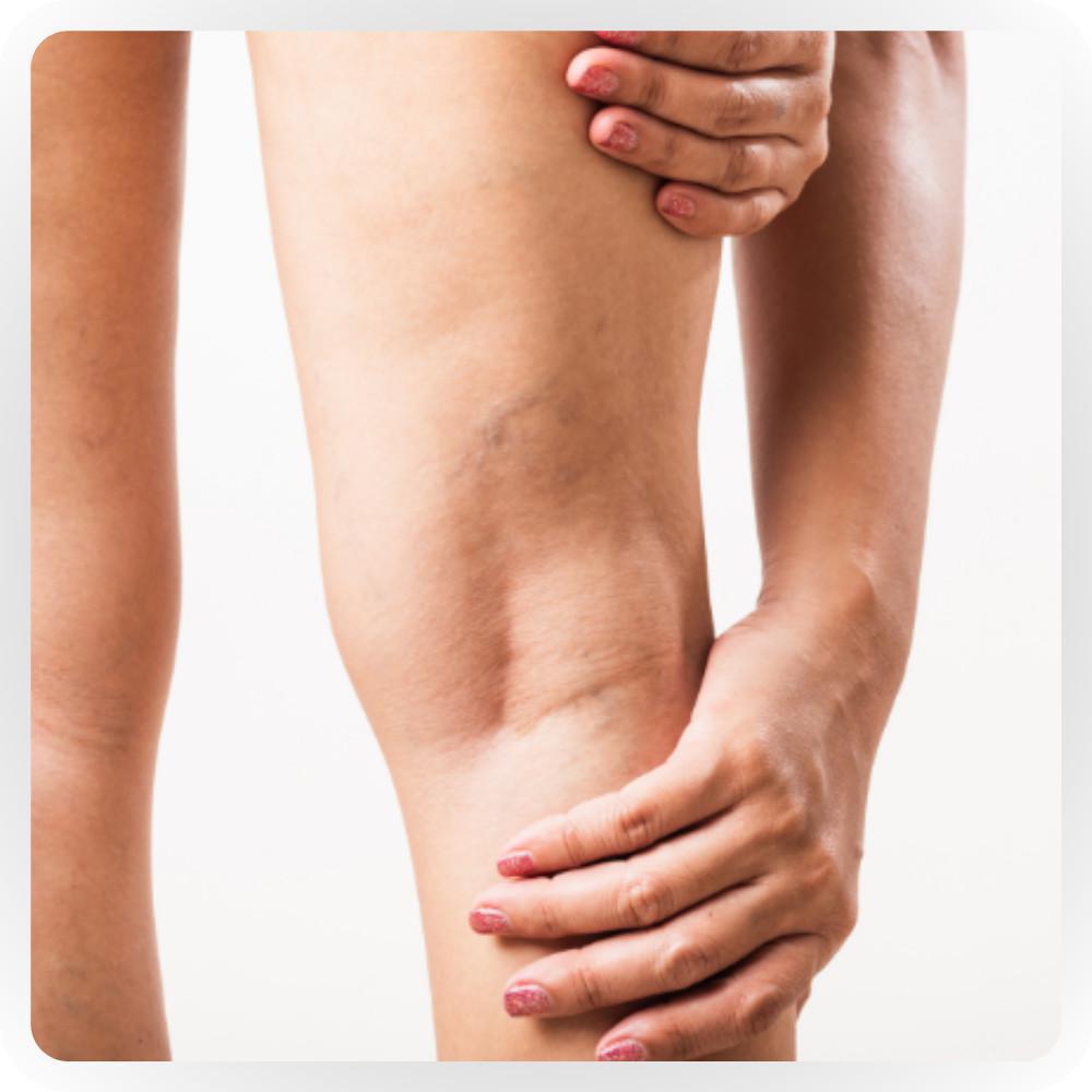 Analisi del ritorno venoso Analisi del ritorno venoso