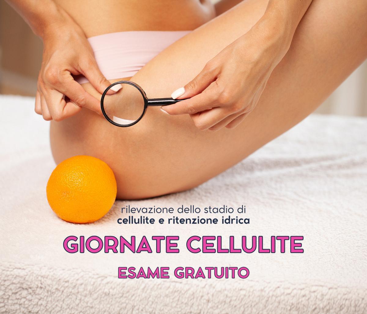 Giornate cellulite Giornate cellulite