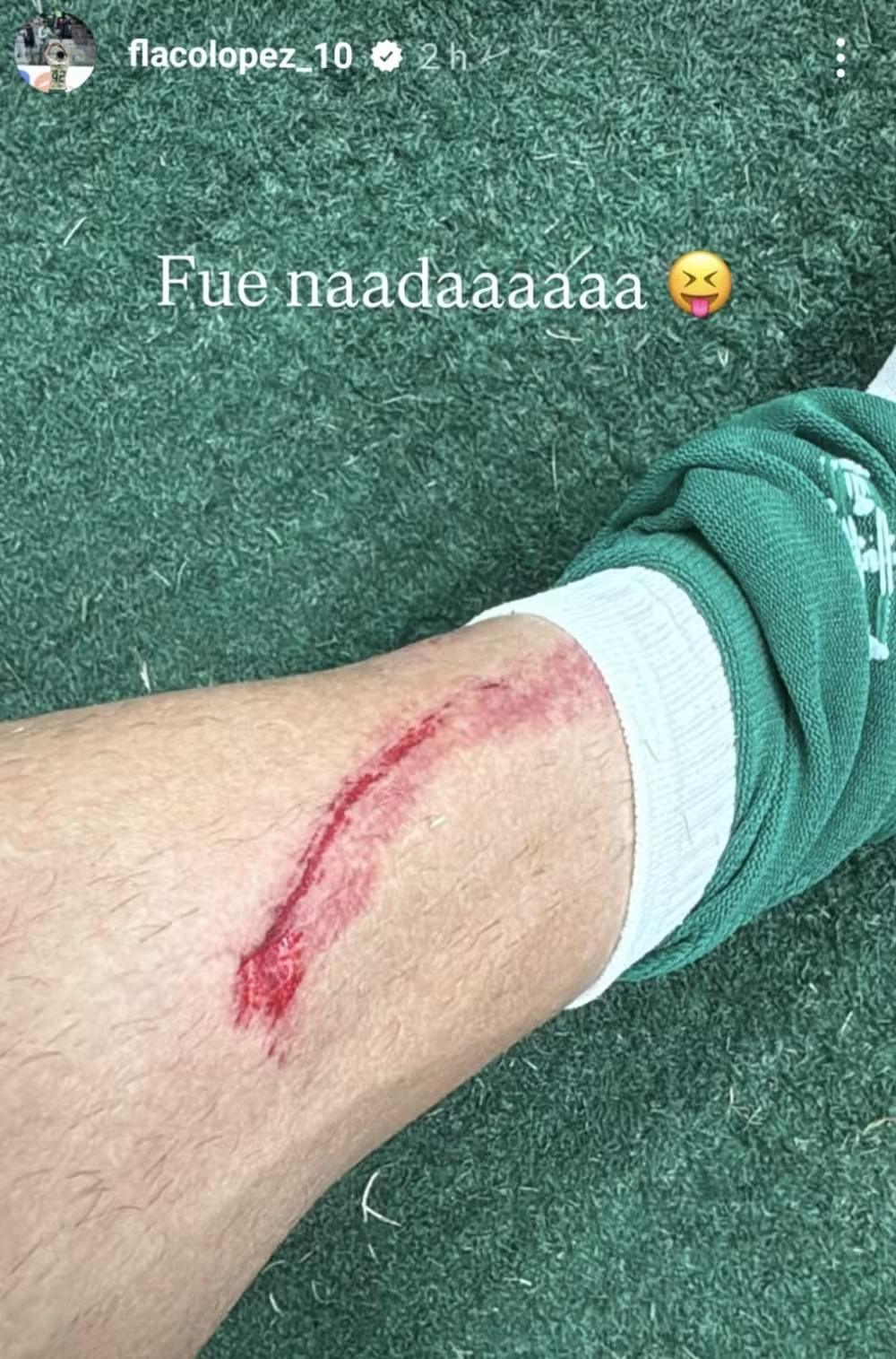 Palmeiras cobrará explicações da FPF por ausência de revisão do VAR em falta sofrida por Flaco López