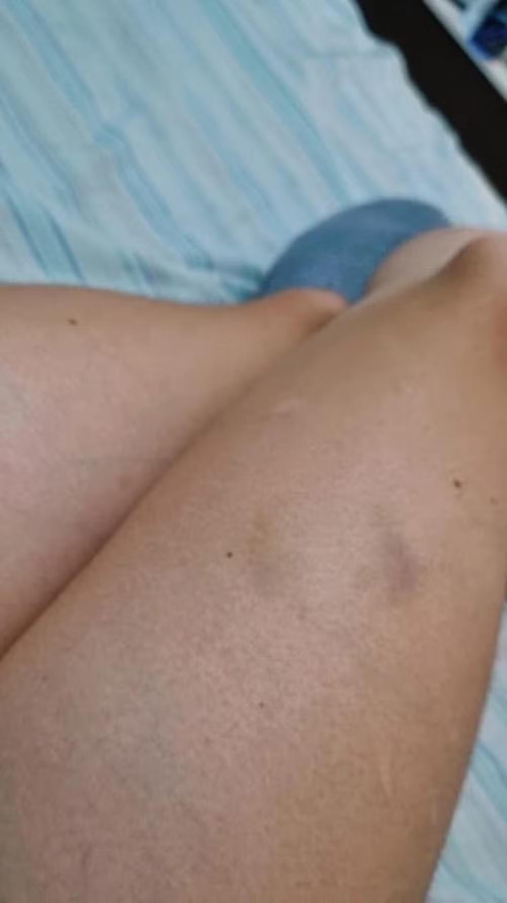 Payet, jogador do Vasco, é alvo de investigação por denúncia de agressão feita por advogada