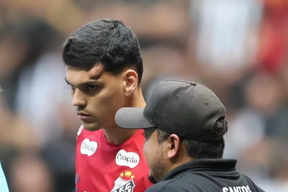 Goleiro Brazão tranquiliza torcida após choque: “Foi apenas um susto”
