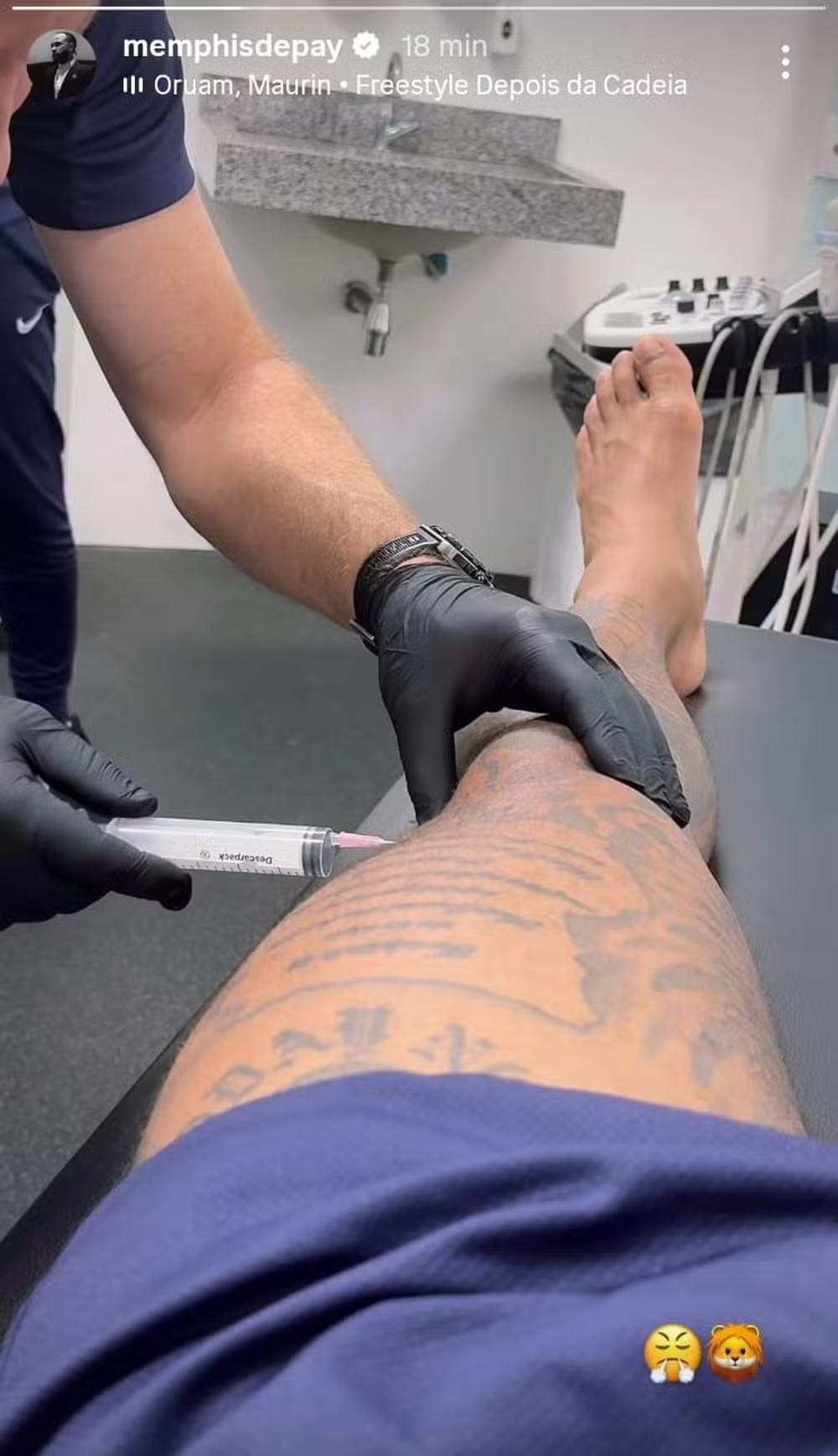 Memphis passa por punção articular no joelho após nova lesão no Corinthians Memphis passa por punção articular no joelho após nova lesão no Corinthians