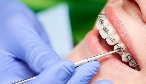 ORTHODONTICS