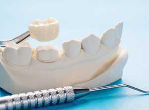 PROSTHODONTICS DENTISTRY