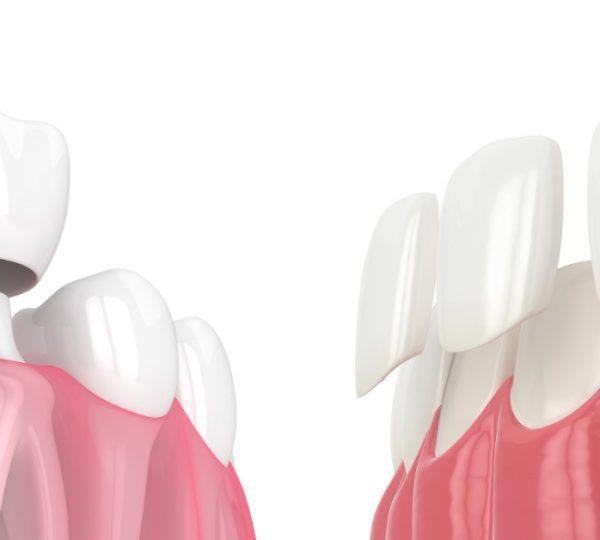 PROSTHODONTICS DENTISTRY