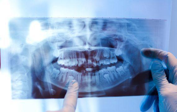 PREVENTIVE DENTISTRY