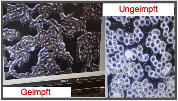 Blutspenden in Ungarn ohne mRNA-Impfstoffe