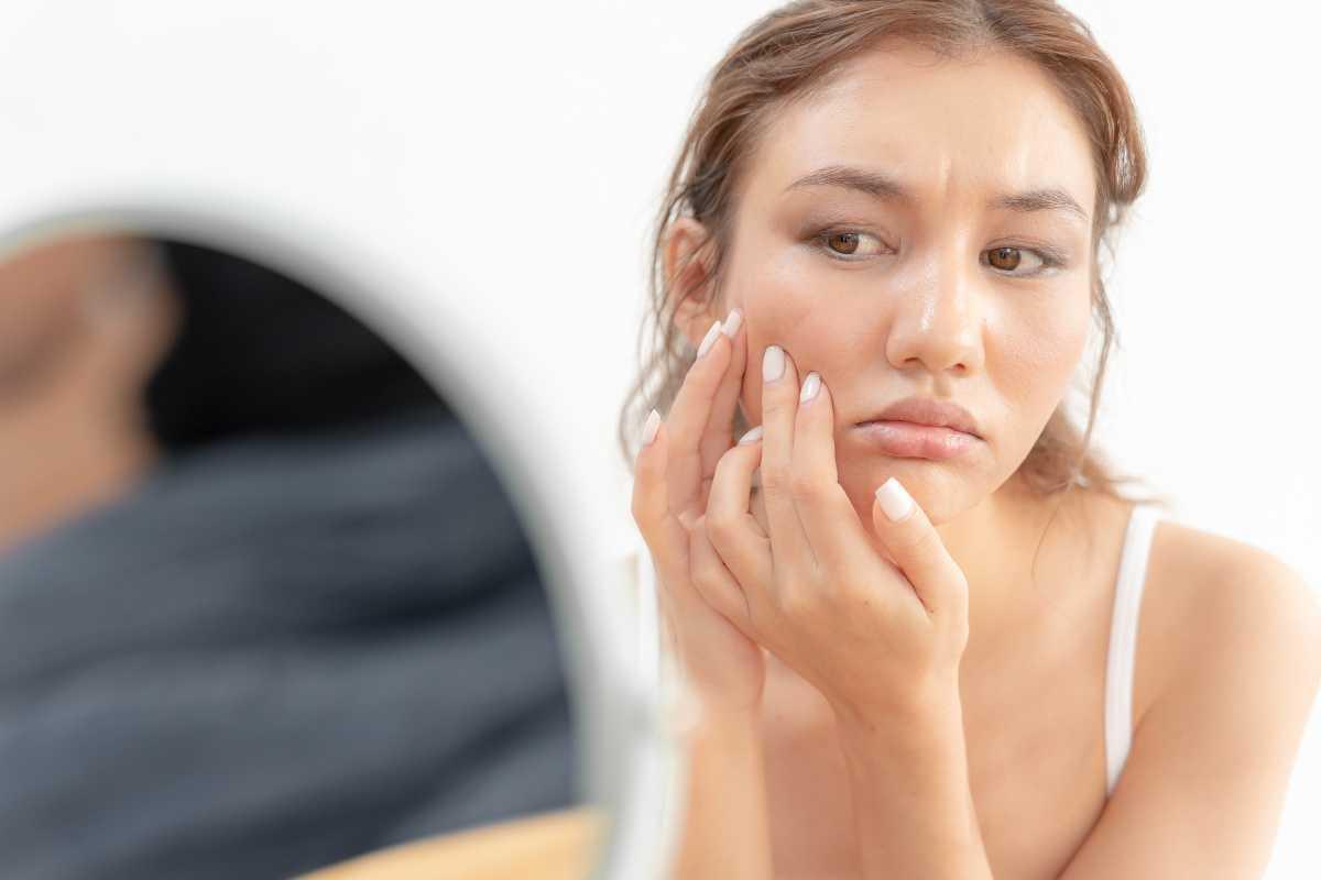 Why Skincare Alone Isn’t Clearing Your Breakouts Why Skincare Alone Isn’t Clearing Your Breakouts