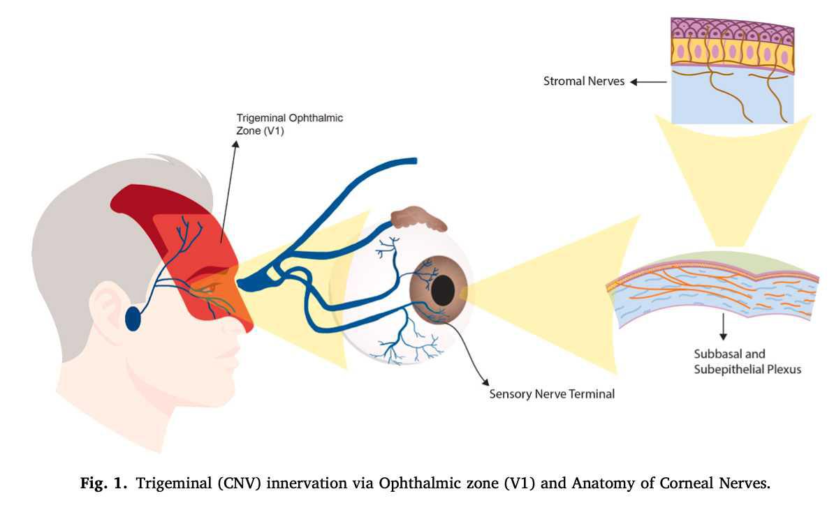 Queratopatía Neurotrófica: Una visión general y una visión al futuro