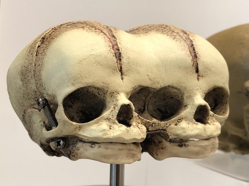 Unis par le crâne Unis par le crâne