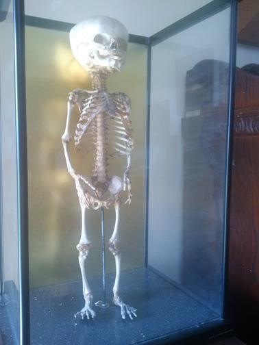 I can see your brain! I can see your brain!