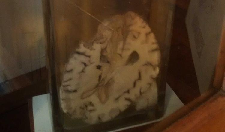 I can see your brain!