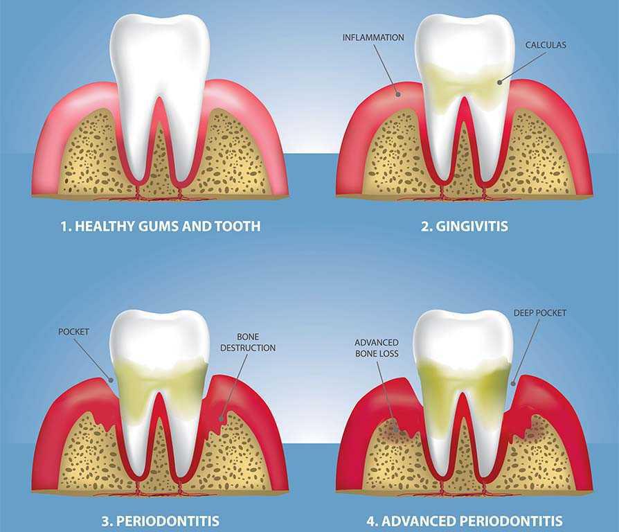 A.C.O. DENTAL A.C.O. DENTAL
