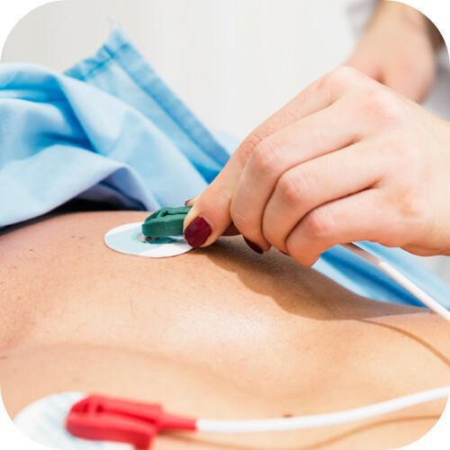 ECG