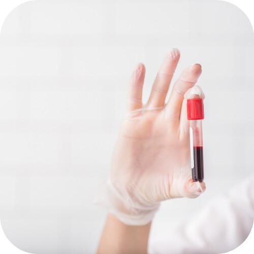 Autoanalisi del sangue