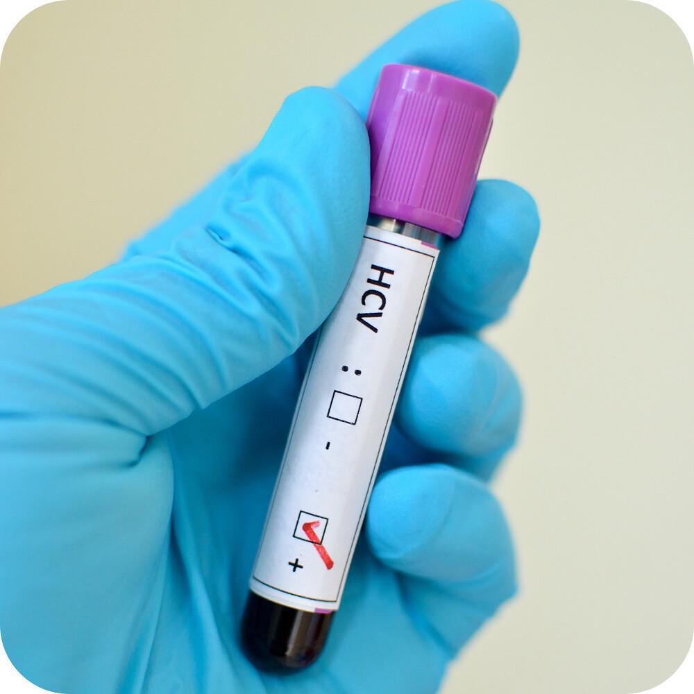 Test anti HCV