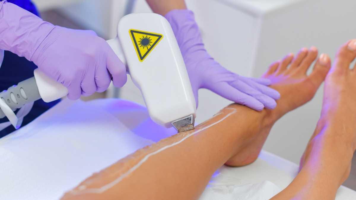 Laser Diodo Servizio Epilazione