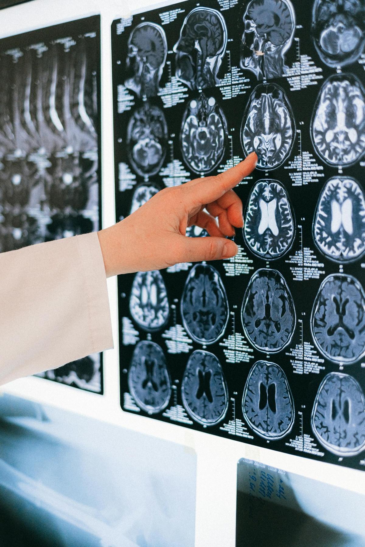 Recharge Right: The Top Ingredient For Brain Health Recharge Right: The Top Ingredient For Brain Health