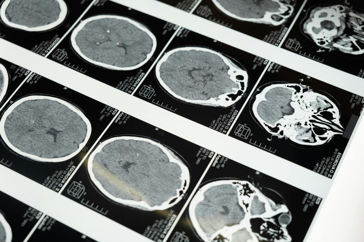 Your Cravings Aren’t Random: How To Break the Dopamine Loop and Reset Your Brain’s Reward System Your Cravings Aren’t Random: How To Break the Dopamine Loop and Reset Your Brain’s Reward System