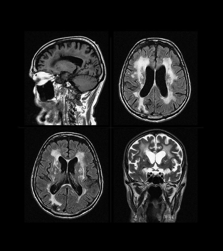 Every Breath You Take: The Overlooked Power of Breathing for Brain and Body Health Every Breath You Take: The Overlooked Power of Breathing for Brain and Body Health