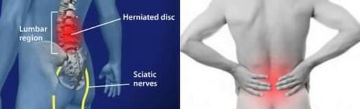 Indicazioni terapeutiche Indicazioni terapeutiche