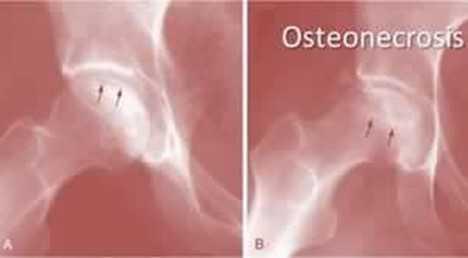 Indicazioni terapeutiche Indicazioni terapeutiche
