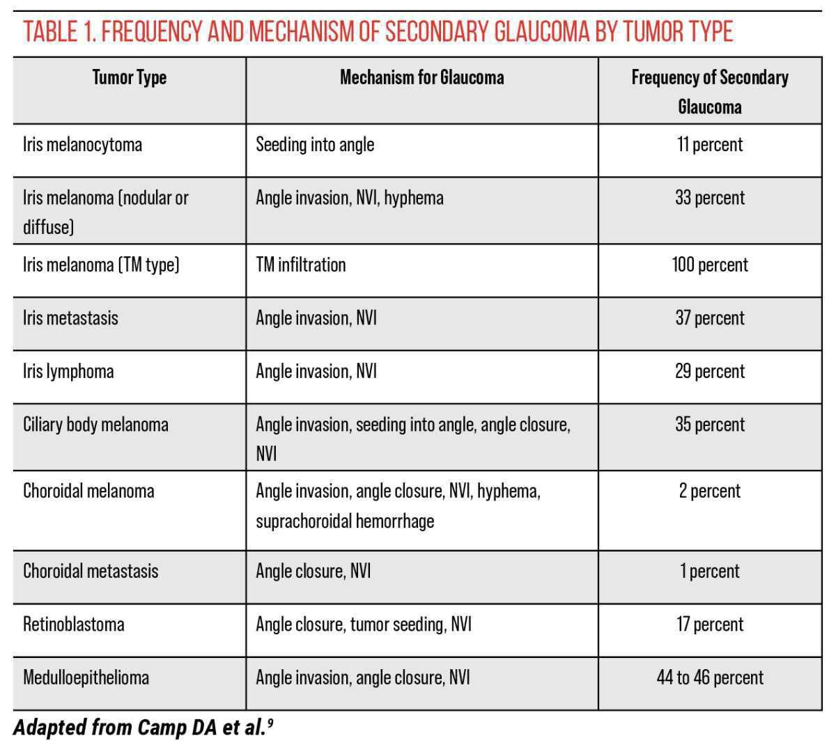 Tumores intraoculares y glaucoma