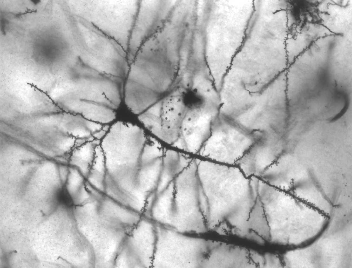 What Is Neuroplasticity? Your Brain, Under Construction
