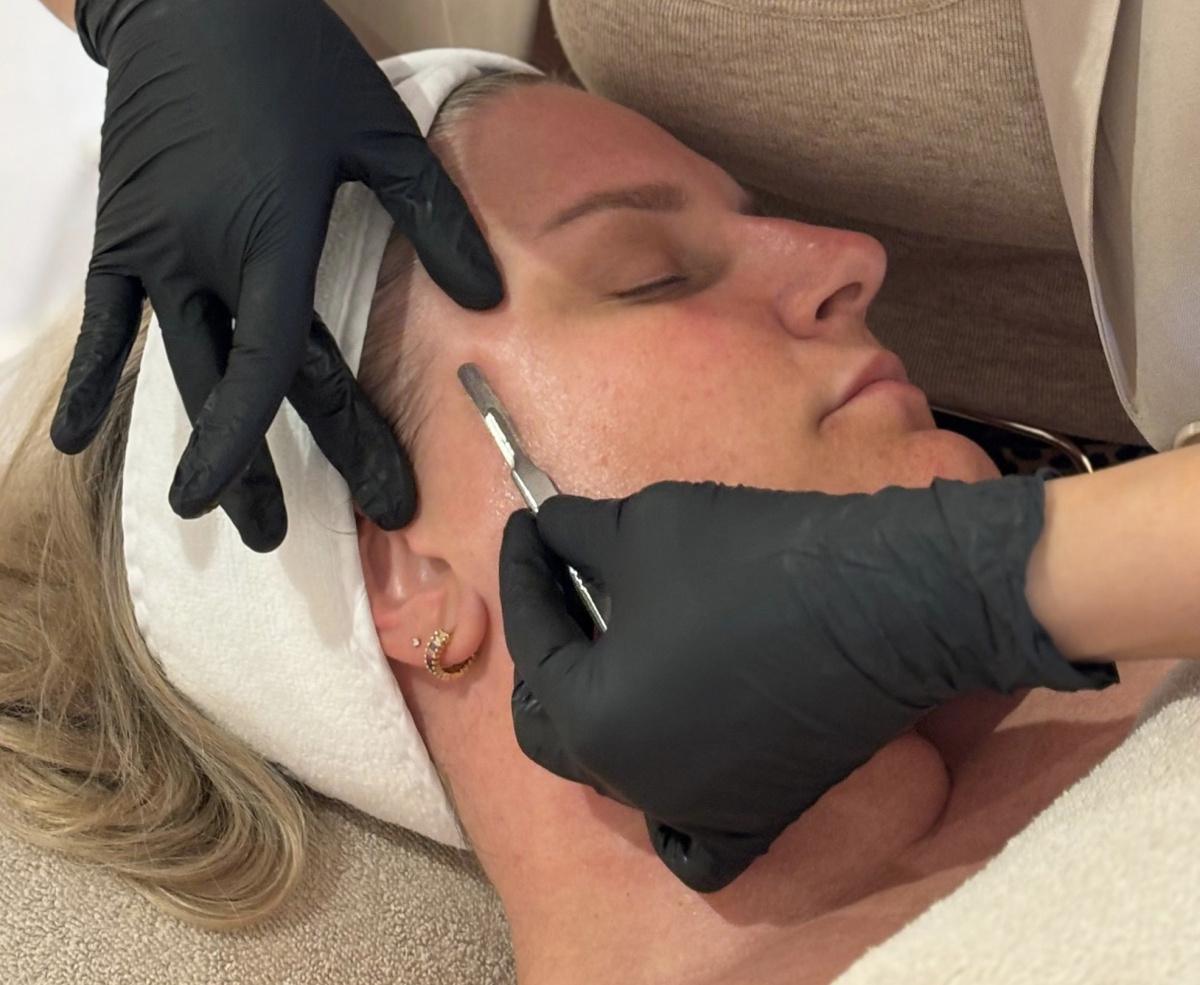 Dermaplaning Dermaplaning