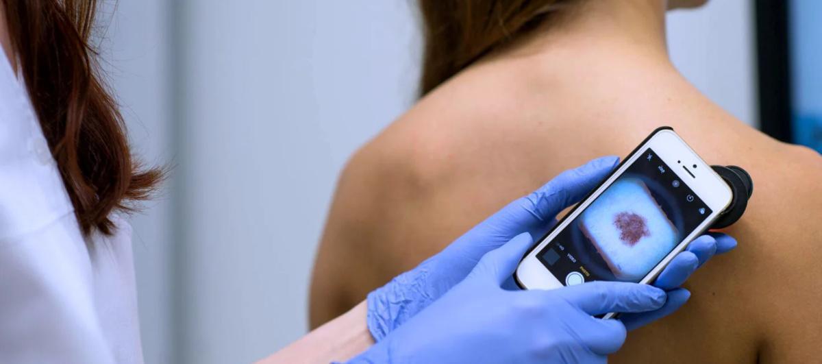 Teledermatologia