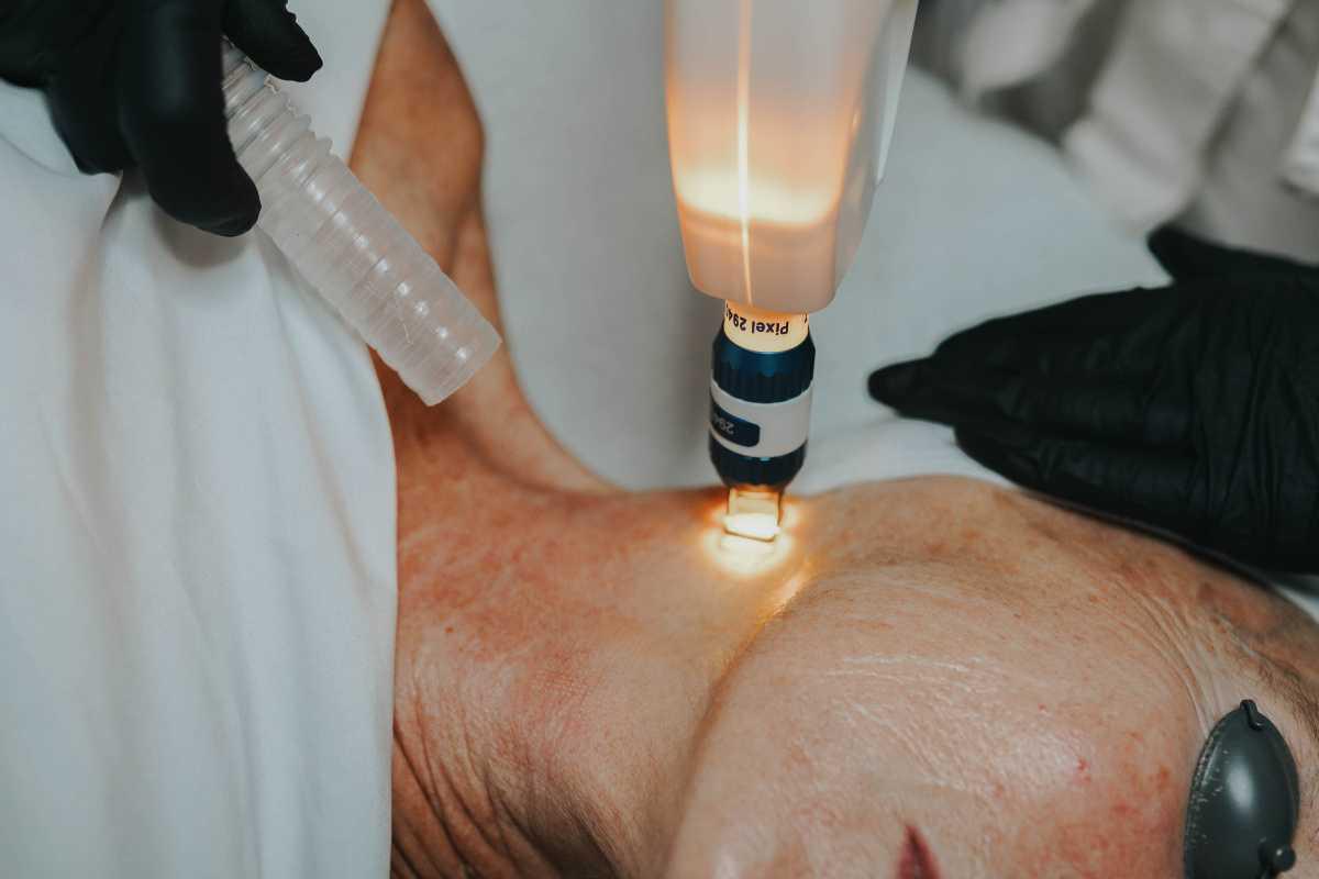 Laser Skin Resurfacing