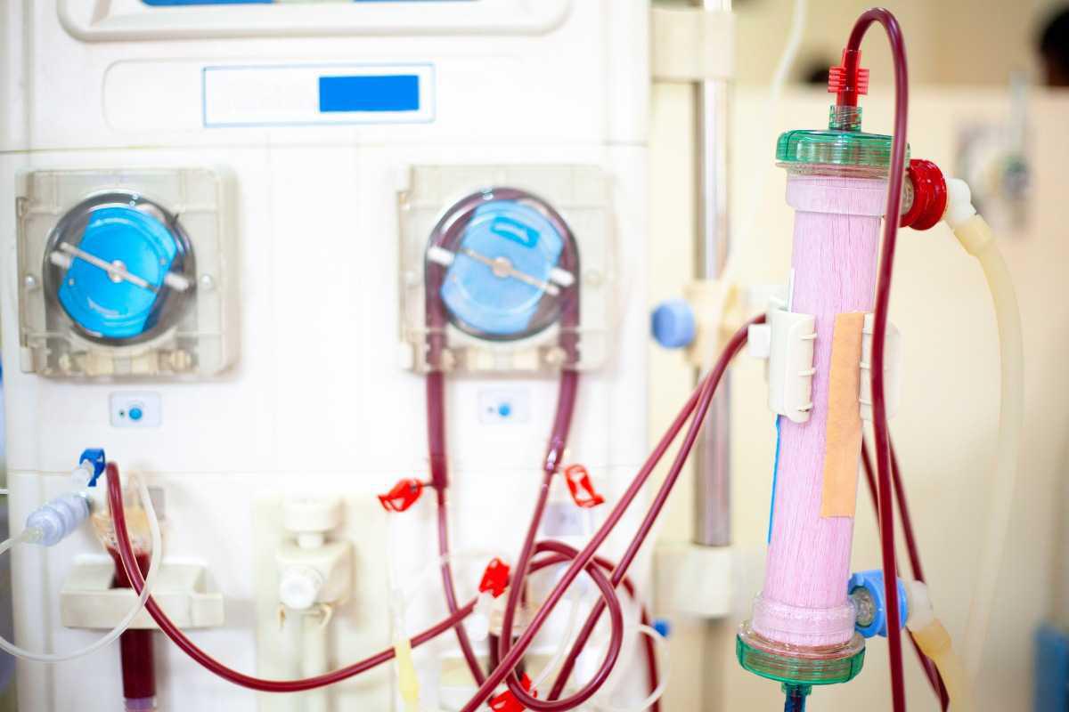 Quali sono gli effetti collaterali della dialisi? Quali sono gli effetti collaterali della dialisi?