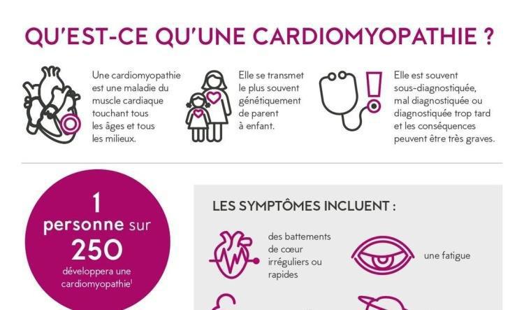 La cardiomyopathie : quels sont les signes qui doivent alerter ?
