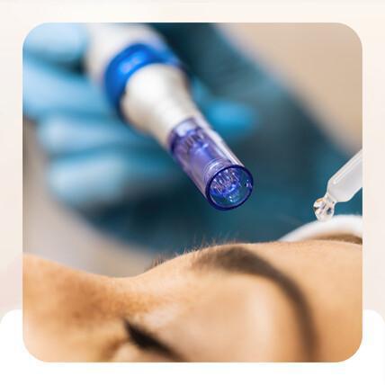Trattamento Derma Pen