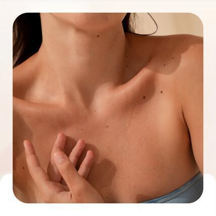 Trattamento nuova pelle