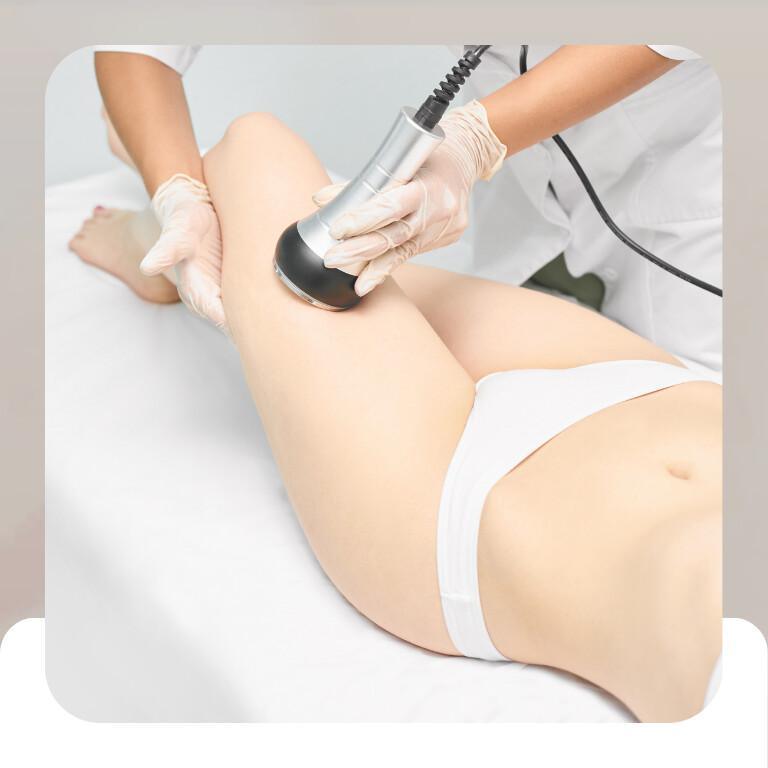 Radiofrequenze Radiofrequenze