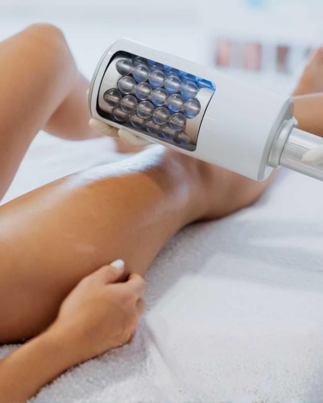 🦵 Gambe pesanti e cellulite da ufficio? La verità su Endosphere