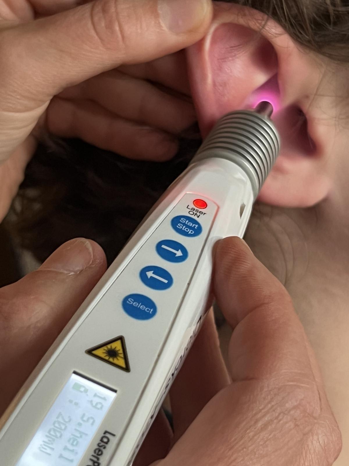 Laserakupunktur – sanfte Alternative ohne Nadeln