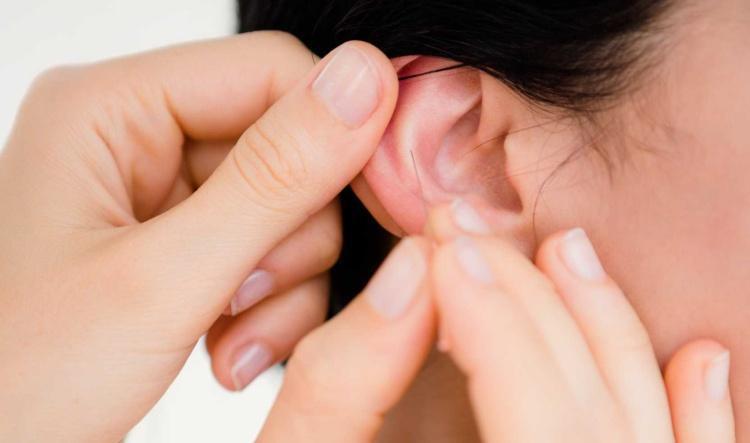 Ohrakupunktur – ganzheitliche Wirkung über das Ohr