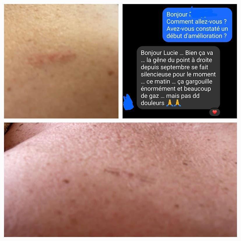 Retour soin sur Zona