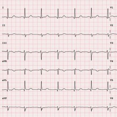 12-Lead EKG: From Start to Competent in 3 Hours! 12-Lead EKG: From Start to Competent in 3 Hours!