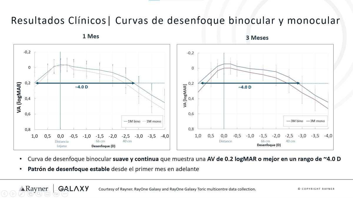 Transformando la visión con la LIO Espiral Galaxy Transformando la visión con la LIO Espiral Galaxy