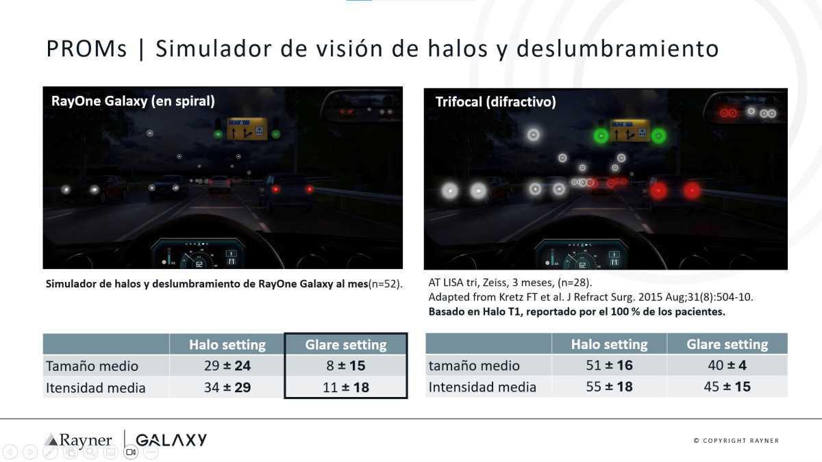 Transformando la visión con la LIO Espiral Galaxy