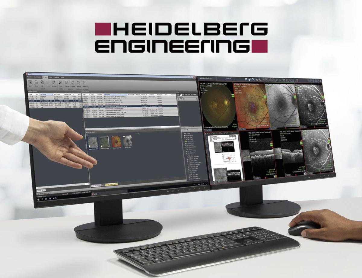 HEYEX 2: Diseñado para el futuro del cuidado de la visión
