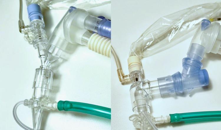 In-line Suction Procedure