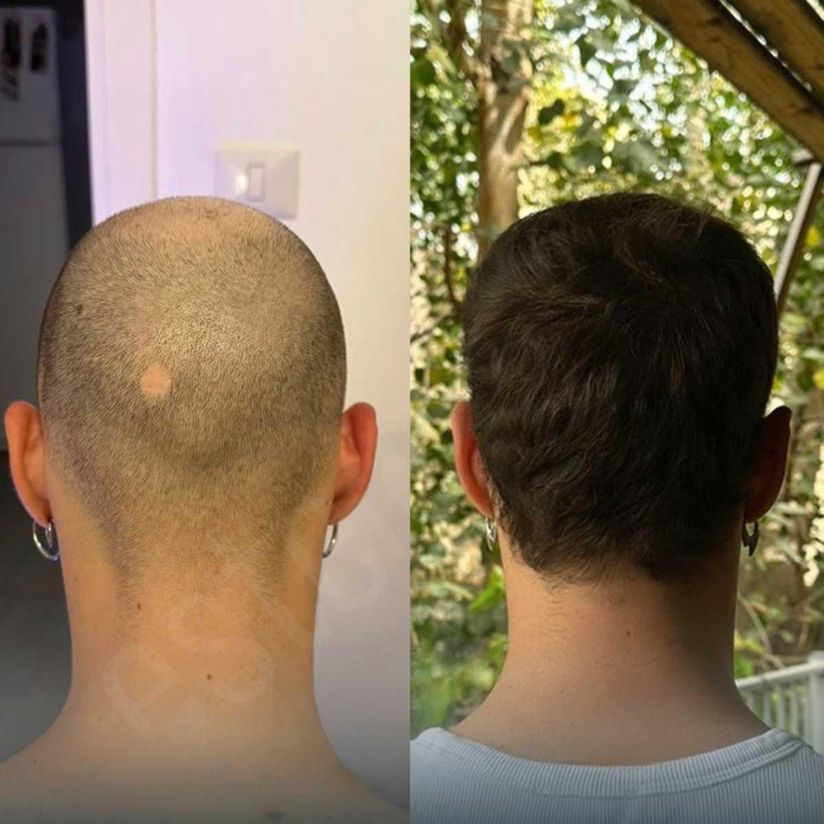 Testimonianze pazienti Testimonianze pazienti