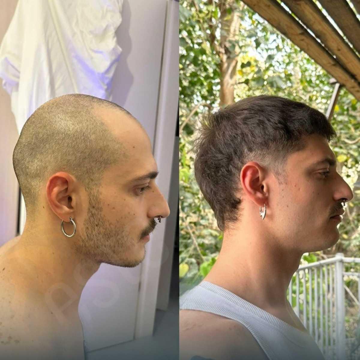 Testimonianze pazienti Testimonianze pazienti