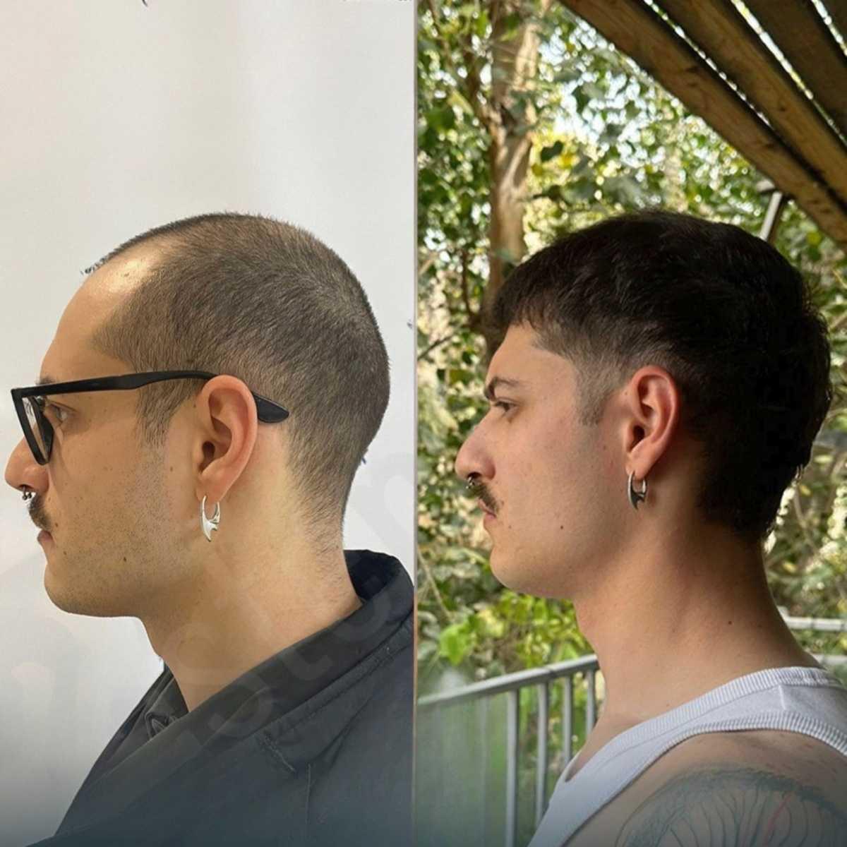 Testimonianze pazienti Testimonianze pazienti