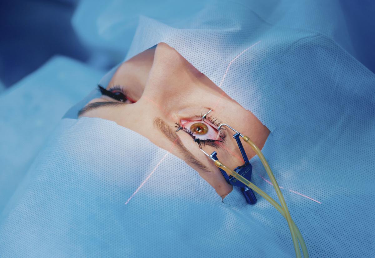 Riesgos retinianos en la miopía y la cirugía LASIK