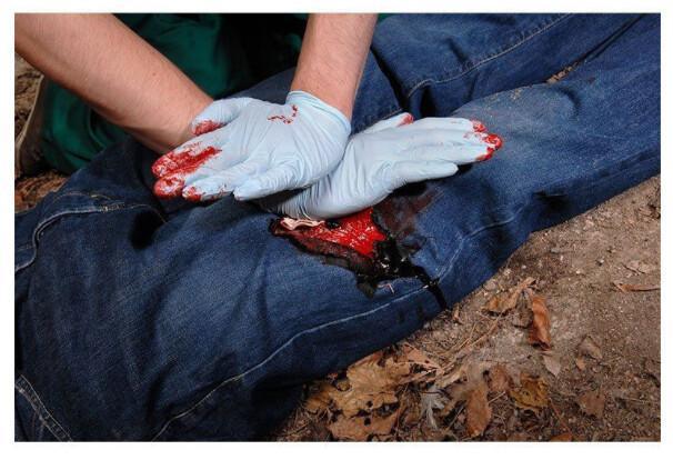 CELOX RAPID | VENDA HEMOSTÁTICA PARA EL CONTROL DEL SANGRADO CELOX RAPID | VENDA HEMOSTÁTICA PARA EL CONTROL DEL SANGRADO